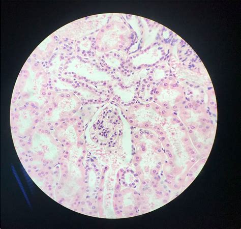 nephron histology Diagram | Quizlet