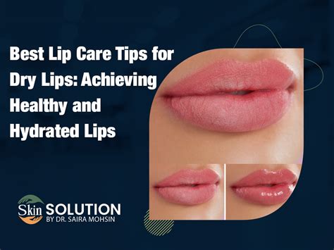 Best Lip Care Tips For Dry Lips Achieving Healthy And Hydrated Lips Dr Saira Mohsin