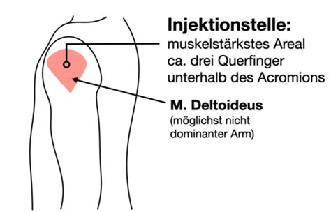 Ce A I M Injektion Karteikarten Quizlet