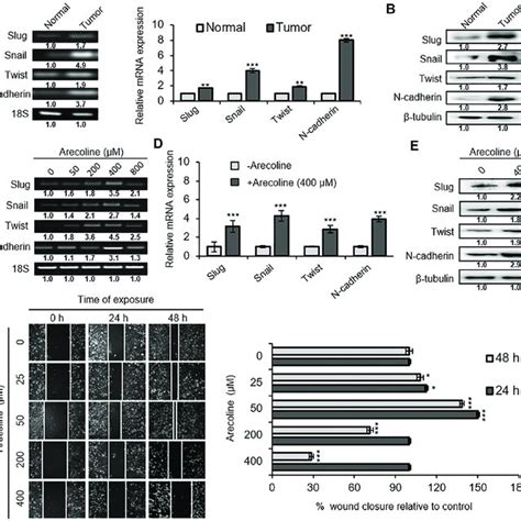 Arecoline Induces Emt In A Dose Dependent Manner A Expression Of