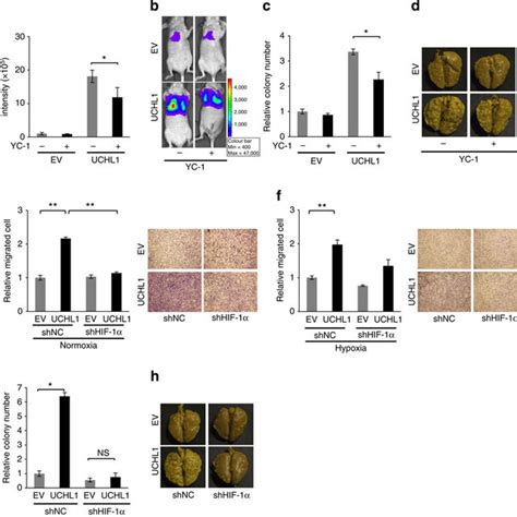 Uchl1 Is A Good Prognostic Marker Ac Human Breast Tumour Sections