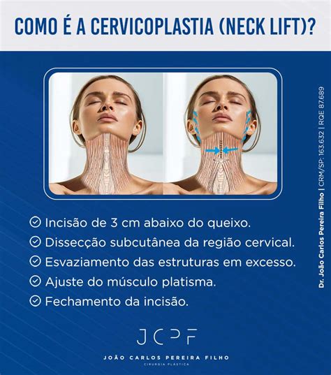 Cervicoplastia O Que É - Cervicoplastia Devolve Beleza Ao Pescoço