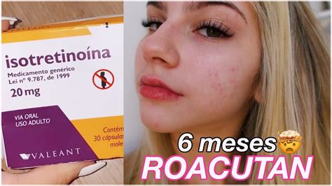 6 MESES TOMANDO ROACUTAN Diário do Roacutan 7 YouTube