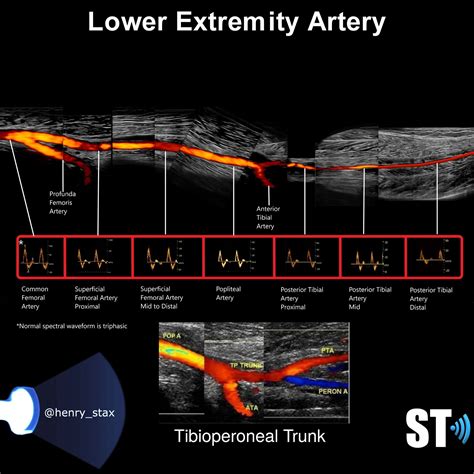 Arterial Sonography Of The Upper And Lower Extremities Sonographic