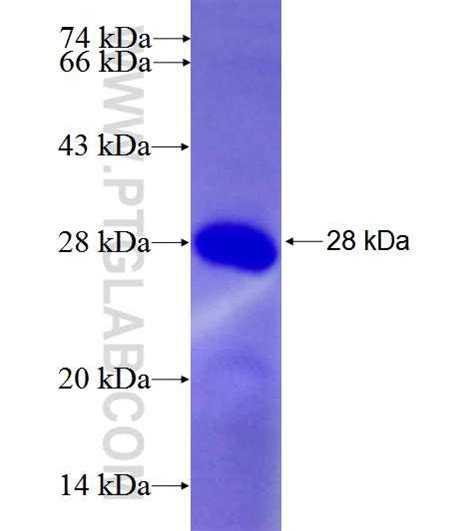 TRIM8 Fusion Protein Ag26544 Proteintech