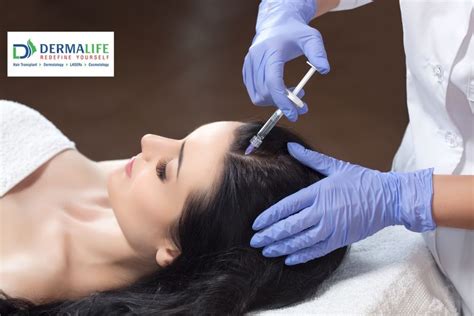 Treatment For Hair Fall Mesotherapy Bio Gen Therapy Dermalife Blog