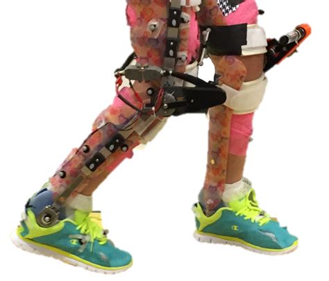 Study Shows Wearable Robotic Exoskeletons Improve Walking For Children