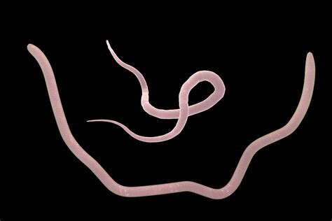 Roundworms in Horses - Symptoms, Causes, Diagnosis, Treatment, Recovery, Management, Cost