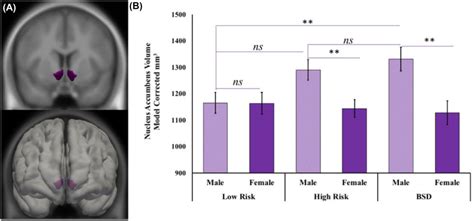 Nucleus Accumbens Volume By Risk‐group Status And Sex A Displays A