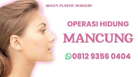 Operasi Hidung Mancung Queen Plastic Surgery Queen Bedah Plastik