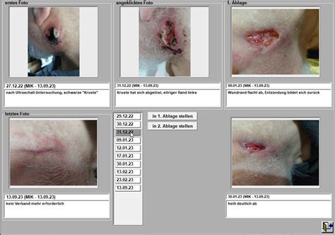 Leistungsbeschreibung Wund Dokumentation In Mikis Carebrain