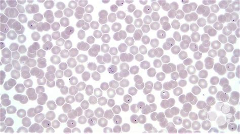 Plasmodium falciparum