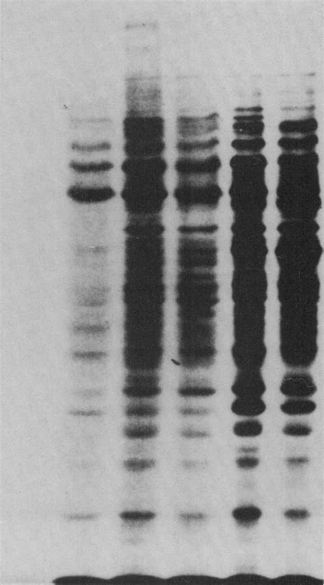 Comparison Of 35s Methionine Labelled Proteins In Cytosol Fractions Of