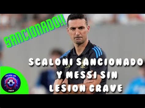 SCALONI SANCIONADO MESSI SIN UNA LESIÓN GRAVE CASI CONFIRMADO EL