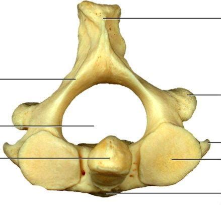 Superior View Of Axis C Diagram Quizlet