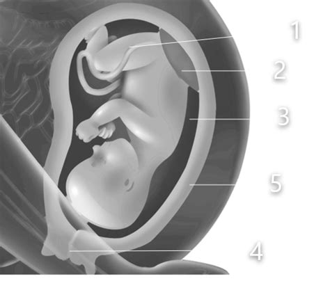 The Diagram Given Below Is That Of A Developing Human Foetus In The