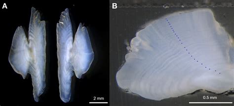 Panel Showing A Photo Of The Whole Otoliths And B Photo Of The