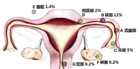 黄体破裂的症状图片 黄体破裂图片大全 黄体破裂 39疾病百科