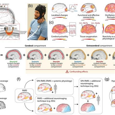 FNIRS Neuroimaging Visualization Of Key Aspects A Illustration Of A