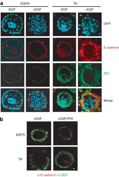 Expression Of Cell Junction Proteins In Mdck Cysts Grown In Collagen