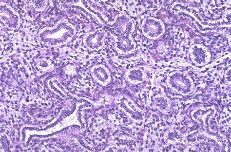 Normal Histology