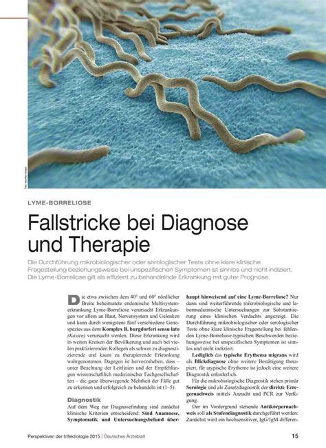 Lyme Borreliose Fallstricke Bei Diagnose Und Therapie