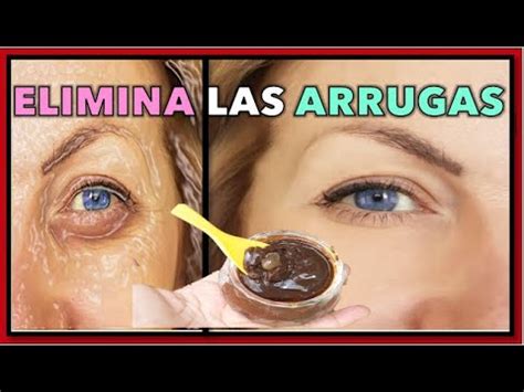 COMO ELIMINAR LAS ARRUGAS PREMATURAS YouTube