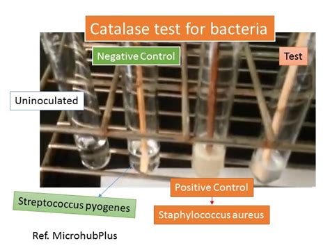 Catalase Test Introduction Principle Procedure Result Interpretation 68272 Hot Sex Picture