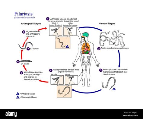 Cavidades Serosas Filariasis De Ciclo De Vida Diagrama Que Muestra El Ciclo De Vida De Los