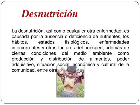 Desnutrición