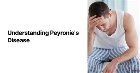 Understanding Peyronies Disease