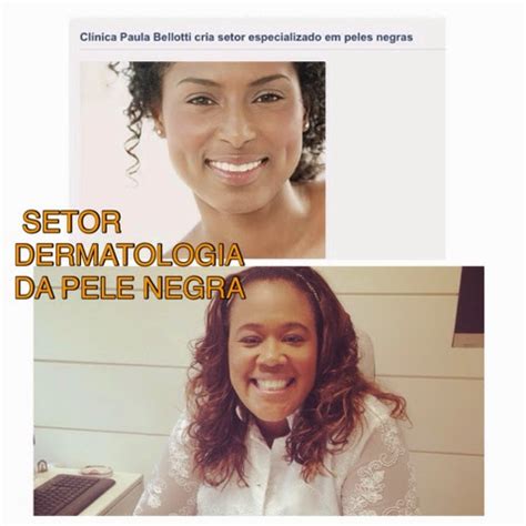 Dermatologista Em Pele Negra Tratamento Da Pele Negra No Rio De Janeiro