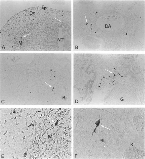 Melanoblasts Arrows Demonstrated By The Dopa Reaction In Cross