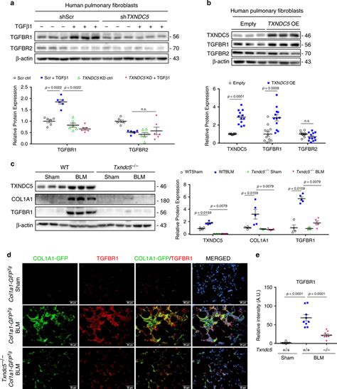 TXNDC5 Modulates TGFBR1 Expression In Human Lung Fibroblasts And Mouse