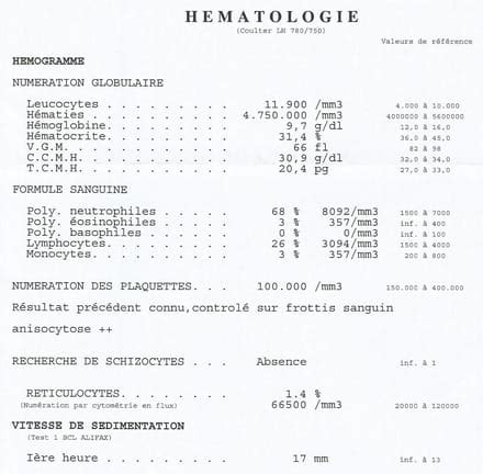 Résultat prise de sang