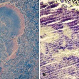 (A) No acid-fast-bacilli are seen (AFB, ×200). (B) A gram stain ...