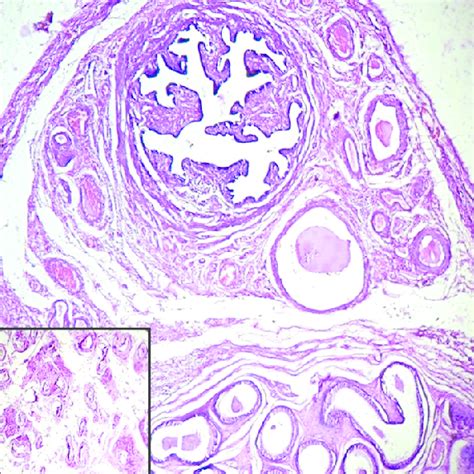 Photomicrograph Showing Fallopian Tube And Epididymis Side By Side