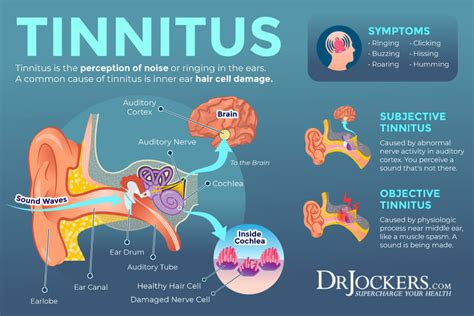 Tinnitus Symptoms Causes And Natural Support Strategies