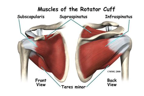 Rotator Cuff Tear Diagram