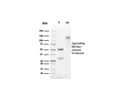 85 1329 28 Hsp60 （heat Shock Protein 60） （mitochondrial Marker） 100ug