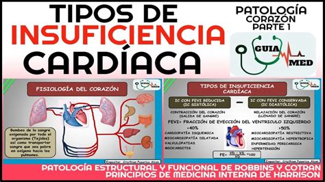 INSUFICIENCIA CARDÍACA DERECHA E IZQUIERDA FISIOPATOLOGÍA GuiaMed