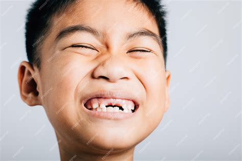 Premium Photo | Boy grins missing upper tooth gap evident Child dental ...