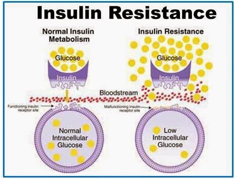 Generalidades De Diabetes Mellitus Tipo 2 Resistencia A La Insulina Y Cambios MetabÓlicos