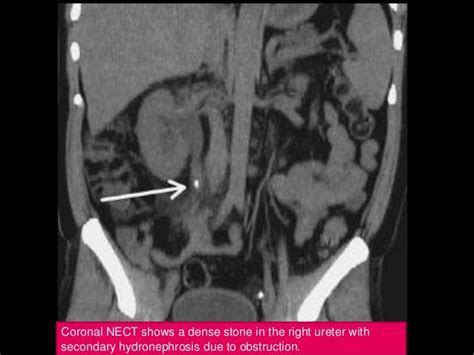 2 abdomen pathology ct