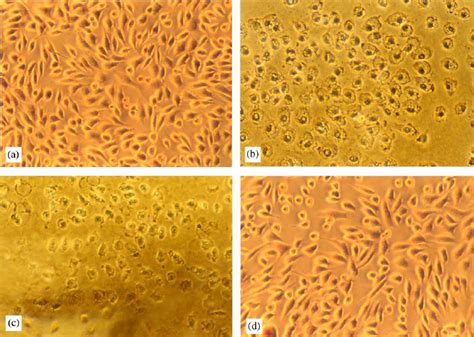 Photographs 100 Â Of L929 Cell Line With Different Ferrite