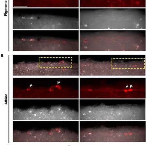 Ohst Tracing From The Optic Nerve Reveals That Not All Melanopsin Cells