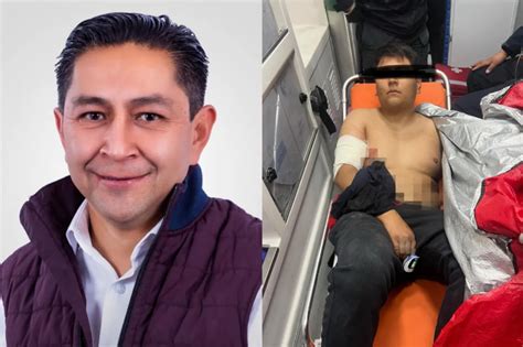 Policías Disparan A Hijo Candidato A La Alcaldía De Metepec Edomex