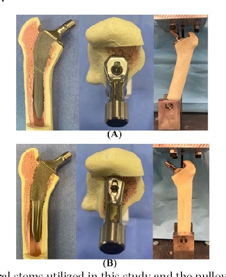 Figure From Biomechanical Comparison Of Impaction Techniques And