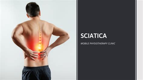 Sciatica Symptoms Causes Prevention Exercises Diagnosis