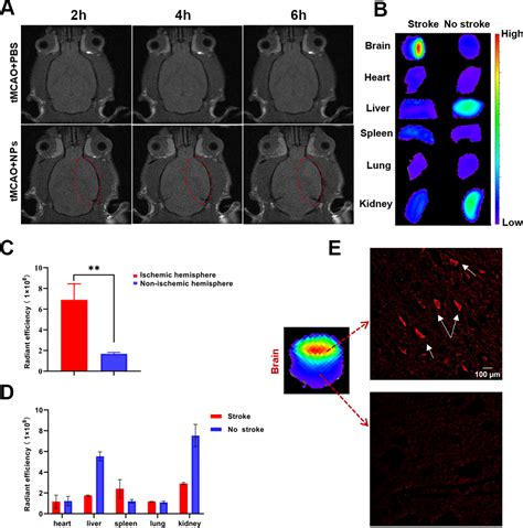 Ph Responsive Multifunctional Theranostic Rapamycin Loaded